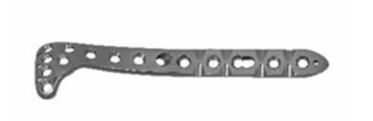 Проксимальна латеральна блокуюча пластина для великогомілкової кістки UMP